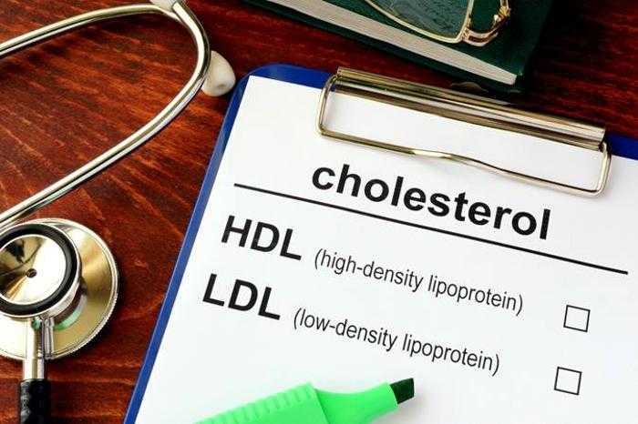 الفحص الدوري لمستويات الكوليسترول بالدم