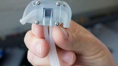 وداعًا لغسيل الكُلى