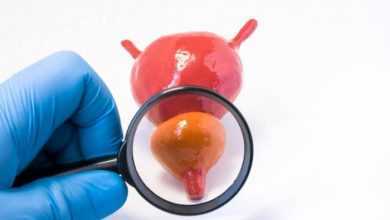 التشخيص المبكر لسرطان البروستاتا