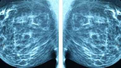 الذكاء الاصطناعي يتفوق على الخبراء البشريين