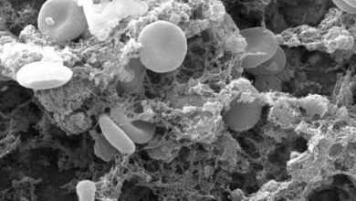 الأسباب المؤدية للوفاة