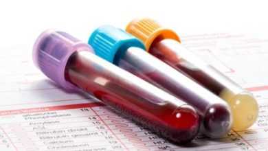 يمكنها التنبؤ بخطر تليف الكبد