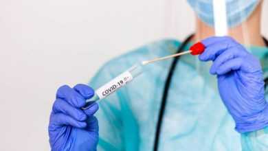 اختبارات الكشف عن فيروس كورونا قد تُعطي نتائج "سلبية كاذبة"