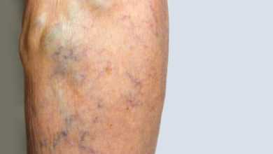 أفضل أطباء الأوعية الدموية بمحافظة الجيزة