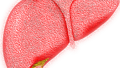 كيف يمكن الشفاء من الكبد الدهني