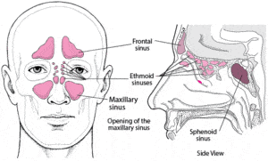 أعراض التهاب الجيوب الأنفية وبعض النصائح لتخفيفها أعراض التهاب الجيوب الأنفية وبعض النصائح لتخفيفها