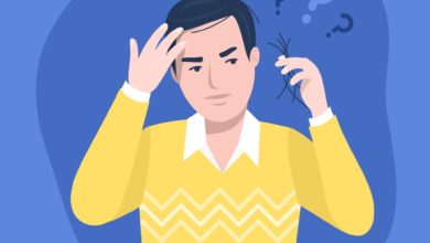 علاجات داء الثعلبة