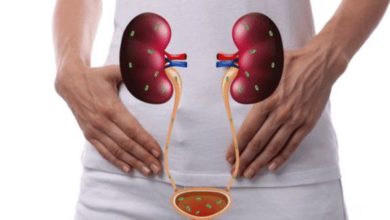 علاج التهاب المسالك البولية