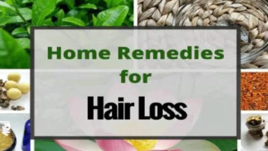 تساقط الشعر