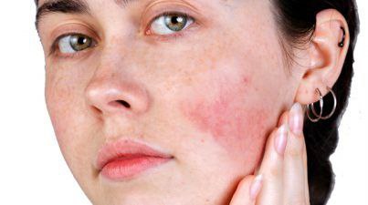 أضرار إزالة الشعر بالليزر