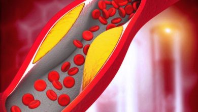 علاج ارتفاع نسبة الكوليسترول