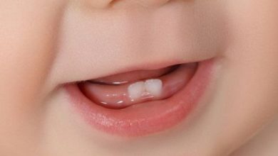 تأخر ظهور الأسنان اللبنية