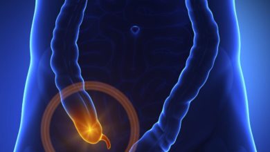 أكلات تسبب التهاب الزائدة الدودية