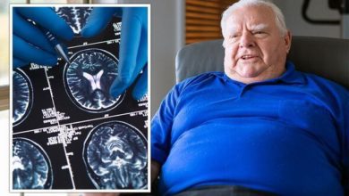 العلاقة بين السمنة ومرض الزهايمر