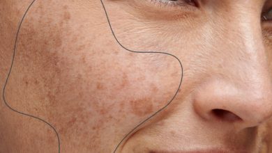 اضطرابات الجلد