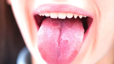 حروق اللسان