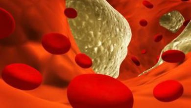 البروتين الدهني