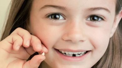 تأخر تبديل الأسنان عند الأطفال
