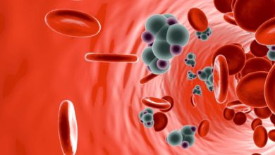 تقليل مقاومة الأنسولين