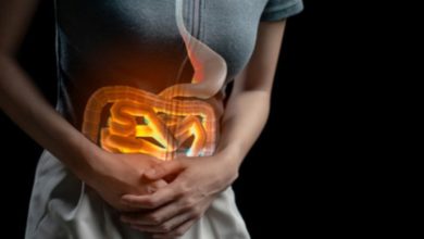 مرضى سرطان الأمعاء