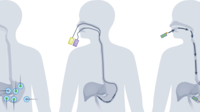 جهاز طبي قابل للابتلاع