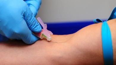 انقطاع النفس الانسدادي النومي