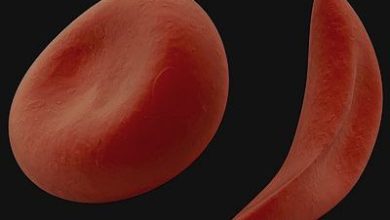 مرض فقر الدم المنجلي